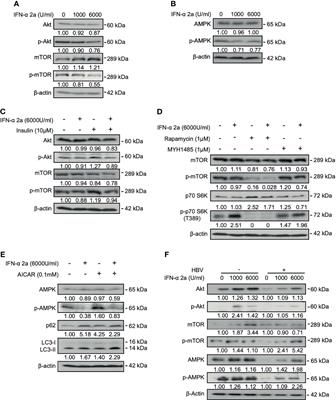 Interferon Alpha Induces Cellular Autophagy and Modulates Hepatitis B Virus Replication